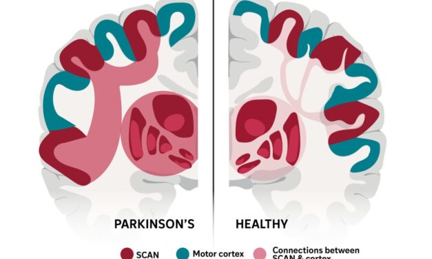 This complex brain network may explain many of Parkinson’s stranger symptoms