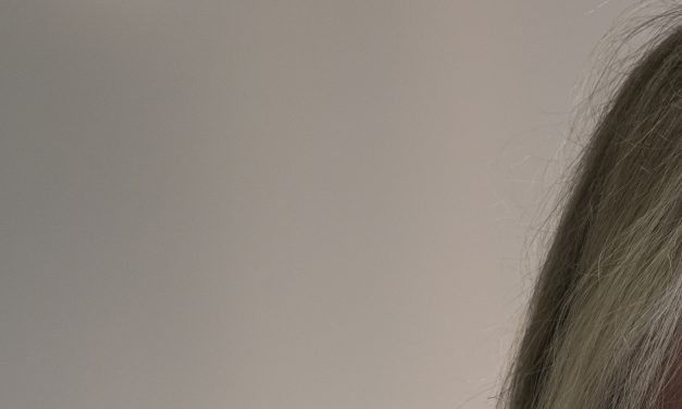 Some Planned Parenthood clinics are using Botox to smooth over federal cuts