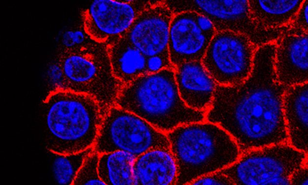 Experimental pill promises new hope for deadly pancreatic cancer