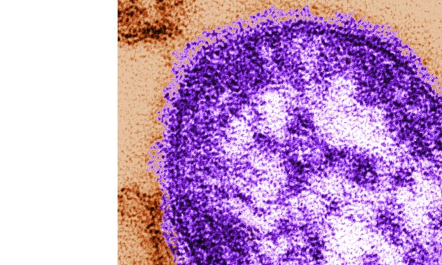 Pennsylvania says an unvaccinated woman has died from measles-related complications